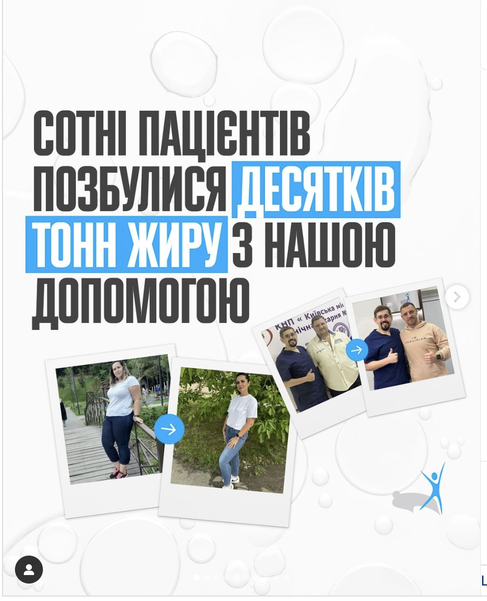 Результати пацієнтів Центру метаболічної хірургії після хірургічного лікування ожиріння